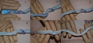 6 umbilical cords